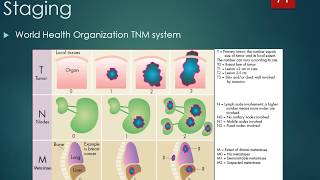 Biology Clinical Manifestations and Treatment of Cancer [upl. by Nesral]