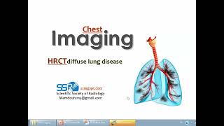 HRCT of diffuse lung disease I DRE Prof Mamdouh Mahfouz [upl. by Raimes]