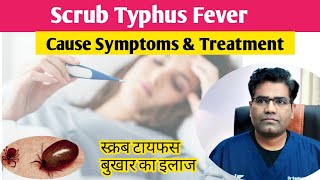 Scrub Typhus Cause Symptoms and Treatment Explained  स्क्रब टाइफस बुखार क्या है [upl. by Leahpar742]