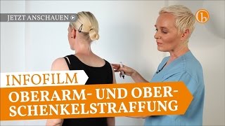 Oberarm amp Oberschenkelstraffung  Erfahrungsbericht  Dr Simone Hellmann Plastische Chirurgie Köln [upl. by Ehrlich497]