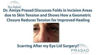 How Skin Tension Can Cause Skin Folds after Eyelid Surgery and How to Prevent Them [upl. by Kasper439]