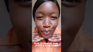 Say goodbye to dark spots amp acne scars with torridenofficial darkspotsremover torriden skin [upl. by Willcox]