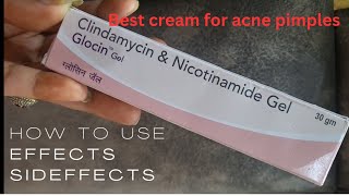 Demelan cream review  हिंदी में  Dr Aanchal Panth [upl. by Haynes]