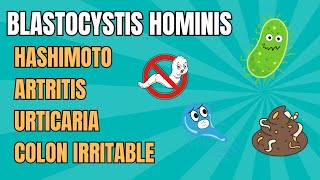 Como deshacerte de BLASTOCYSTIS HOMINIS  Parásito que puede producir HASHIMOTO [upl. by Randie468]