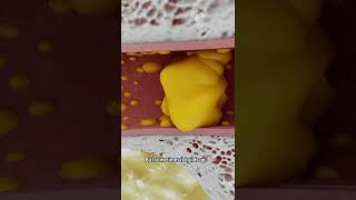 How to Remove Ear Wax Blockage the Right Way shorts facts  creativelearning3d [upl. by Marylinda]