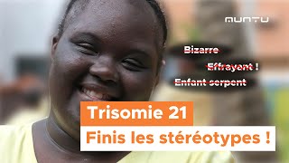 IL EST TEMPS DE METTRE FIN AUX STEREOTYPES SUR LA TRISOMIE 21 [upl. by Haerdna740]