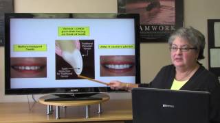 Common Dental Procedures [upl. by Wadell]