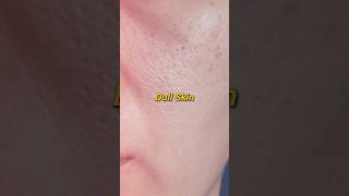 Best Moisturizer for Dull Skin brighteningmoisturiser moisturizer Ad [upl. by Atikam]