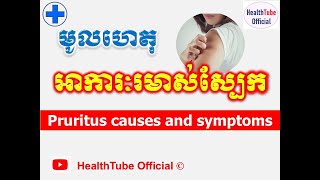 មូលហេតុ អាការៈរមាស់ស្បែក l Pruritus causes and symptoms ll HealthTube Official [upl. by Salguod323]