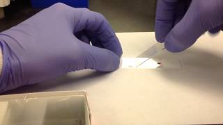 Hematology Making a Peripheral Blood Smear [upl. by Palila]