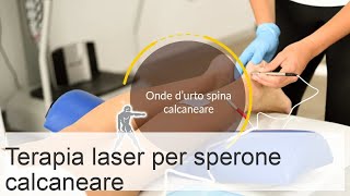 Trattamento speroni calcaneali con laser recensioni corso e controindicazioni [upl. by Winterbottom431]