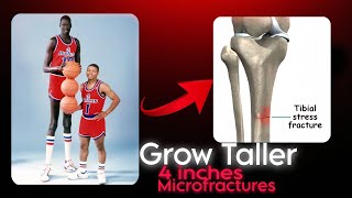 How to GROW taller at any age using MICROFRACTURE METHOD [upl. by Alvina]