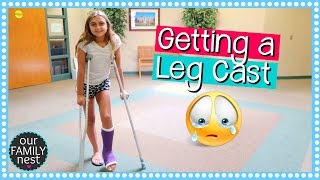 GETTING A LEG CAST FOR BROKEN FOOT  DANCE INJURY [upl. by Eoj172]