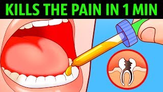 10 Ways to Kill a Toothache In a Minute [upl. by Inoek984]