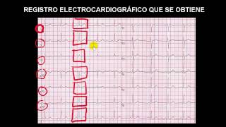 CURSO DE ELECTROCARDIOGRAFIA 08  REGISTRO ELECTROCARDIOGRÁFICO QUE SE OBTIENE [upl. by Wagstaff704]