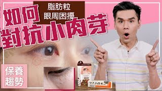 眼周保養困擾：如何對抗小肉芽？ ll Kevin想得美 ll Skincare Problem  How to Treat amp Prevent Milia [upl. by Frayda]