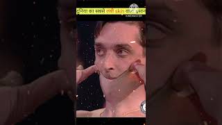 duniya ka sabse lambi skin wala insaan shortvideo [upl. by Aguie]