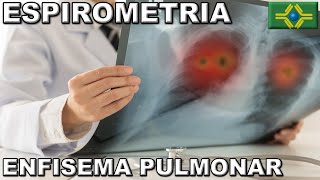 ESPIROMETRIA  DIAGNÓSTICO DE ENFISEMA PULMONAR  Teste de Função Pulmonar [upl. by Ased]