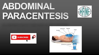 ABDOMINAL PARACENTESIS NURSING PROCEDURE [upl. by Mic]