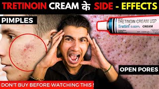 How to Apply Tretinoin Cream I Tretinoin Journey I Tretinoin Side Effects [upl. by Elagibba]