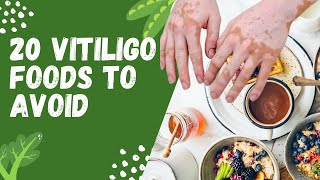 20 Vitiligo Foods to Avoid l Vitiligo Diet Restrictions [upl. by Michaeu]