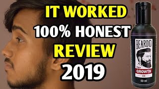 Beardo Beard Hair Growth Oil REVIEW 2019  IT WORKED [upl. by Tibbetts]