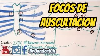 Focos de auscultación cardiaco facil y sencillo [upl. by Alleynad]