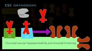 Central Serous Chorioretinopathy Part 3 [upl. by Woodley281]