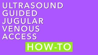 Ultrasound Guided Jugular Venous Access How To [upl. by Maryl]