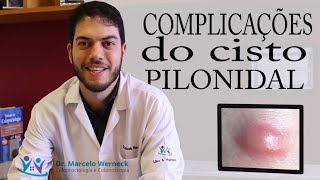 Complicações do cisto pilonidal  Dr Marcelo Werneck [upl. by Anaehr372]