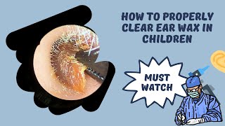 Episode 2 Ear wax removal in children the proper way by The Ear Doctor [upl. by Johanan]