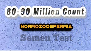 Normozoospermia semen Analysis [upl. by Ennaeirrac]