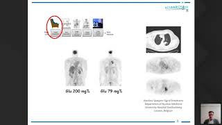 EARL PETCT Accreditation Webinar  todays molecular imaging data for tomorrows needs [upl. by Ardnaid591]