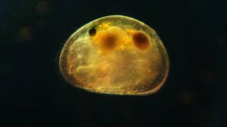 Ostracod egg [upl. by Amairam]