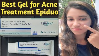 Epiduo Gel for acne amp acne scars  Gel to get rid of pimples  Best cream for acne treatment at home [upl. by Sitruc636]