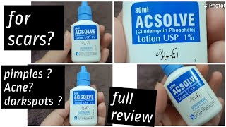 ACSOLVE lotion Review [upl. by Vastha]