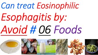 Eosinophilic esophagitis diet symptoms diagnosis treatment causes elimination diet [upl. by Inotna]