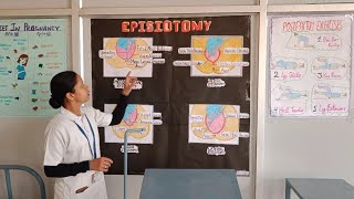 explanation about episiotomy procedure🧑‍⚕️ shortvideo exploremore exploremore episiotomy nurse [upl. by Abdel535]