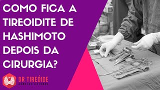 Como fica a Tireoidite de Hashimoto após a tireoidectomia [upl. by Vernita]