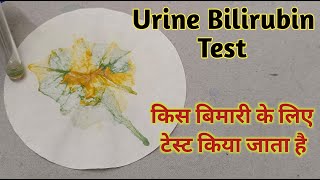 Bile pigment test in urine procedure [upl. by Sisson]