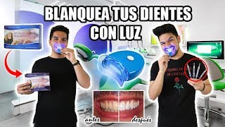 BLANQUEA TUS DIENTES CON LUZ EN 20 MINUTOS  FÁCIL Y RÁPIDO Resultados al Instante [upl. by Renrew]