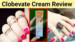 Clobevate Hand Whitening Cream Review Benefits Price Uses Side Effects [upl. by Lazor]