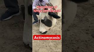 Actinomycosis l lumpy jaw l dr Umar Khan [upl. by Kirchner311]