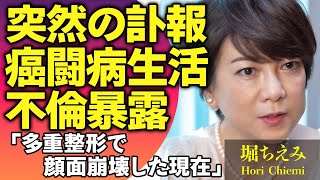 堀ちえみの突然の訃報…余命宣告されていた晩年や闘い続けた癌闘病生活にばみだがこぼれ落ちた…多重整形で顔面崩壊した現在や不倫がばれ社長クビになった真相に驚きが隠せない【芸能人】 [upl. by Rolyat]