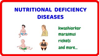 Nutritional Deficiency Diseases Causes Symptoms and Prevention [upl. by Enitsej559]