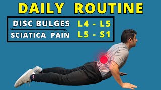 L4 L5 L5 S1 disc bulges best home exercises for pain relief [upl. by Kcirdor804]