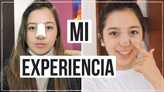 Mi Experiencia Cirugía de Nariz Mariewithem [upl. by Cristian311]