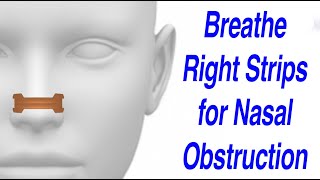 Breathe Right Nasal Strips to Resolve Nasal Obstruction [upl. by Eilra]