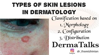 Educationalvideo TERMS IN DERMATOLOGY  TYPES OF LESIONS Dr Thamizhinian  DermaTalks [upl. by Varin]