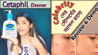 Cetaphil Gentle Skin Cleanser😲Honest Review  My Experience How To Use  Detailed Video [upl. by Solon]